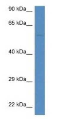 Western Blot: NIP Antibody [NBP1-79883]