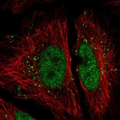 Immunocytochemistry/ Immunofluorescence: NIP30 Antibody [NBP2-55946]