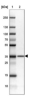Western Blot: NIP30 Antibody [NBP2-13988]