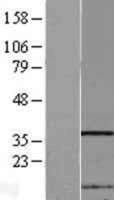 Western Blot: NIP30 Overexpression Lysate [NBL1-13643]