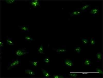 Immunocytochemistry/ Immunofluorescence: NIP7 Antibody [H00051388-B03P]