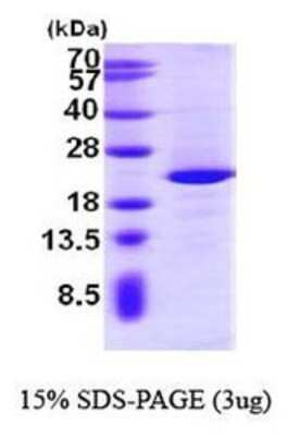 SDS-PAGE: Recombinant Human NIP7 His Protein [NBP1-44472]