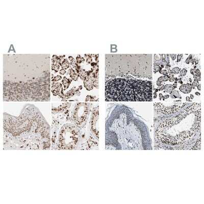 Immunohistochemistry-Paraffin: NIPA Antibody [NBP1-82564]