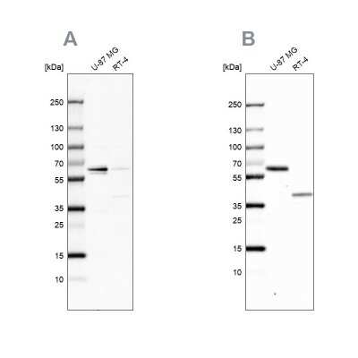 Western Blot: NIPA Antibody [NBP1-82565]