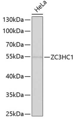 Western Blot: NIPA AntibodyBSA Free [NBP2-93865]