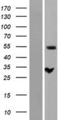 Western Blot: NIPA Overexpression Lysate [NBP2-07034]