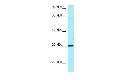 Western Blot: NIPA1 Antibody [NBP2-83269]