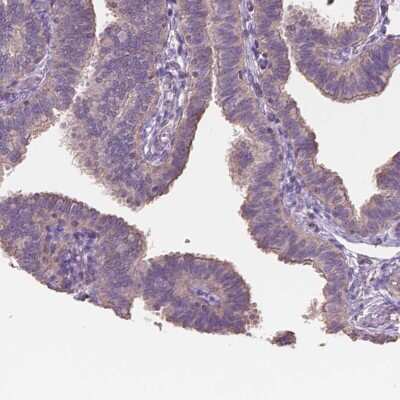 Immunohistochemistry-Paraffin: NIPA2 Antibody [NBP2-49510]