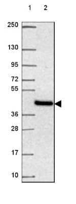 Western Blot: NIPA2 Antibody [NBP2-49510]