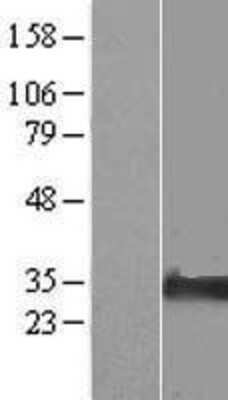 Western Blot: NIPA2 Overexpression Lysate [NBP2-06162]