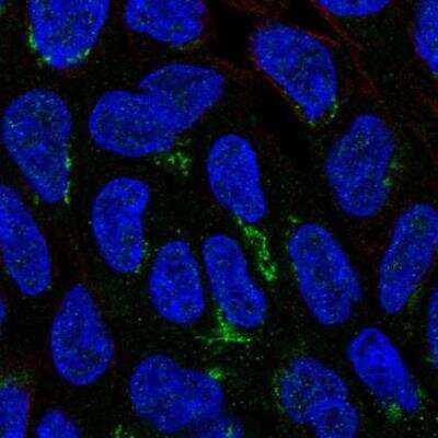 Immunocytochemistry/ Immunofluorescence: NIPAL1 Antibody [NBP1-90518]