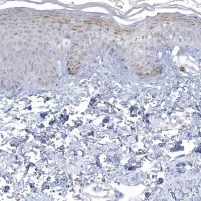 Immunohistochemistry-Paraffin: NIPAL1 Antibody [NBP1-90518]