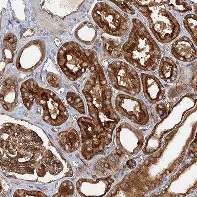 Immunohistochemistry-Paraffin: NIPAL3 Antibody [NBP1-84221]