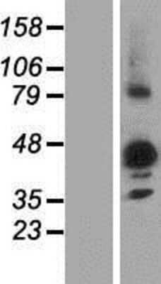 Western Blot: NIPAL3 Overexpression Lysate [NBP2-06639]