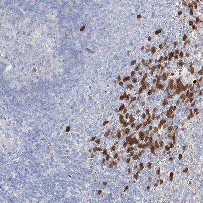 Immunohistochemistry-Paraffin: NIPAL4 Antibody [NBP1-93678]