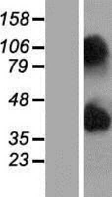 Western Blot: NIPAL4 Overexpression Lysate [NBP2-08278]