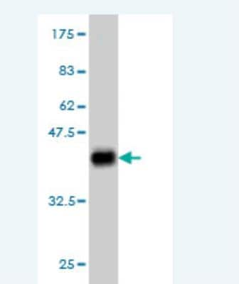 Western Blot: NIPBL Antibody (3B9) [H00025836-M01]