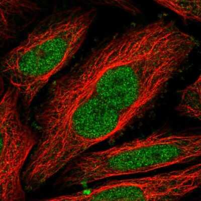 Immunocytochemistry/ Immunofluorescence: NIPBL Antibody [NBP1-85110]