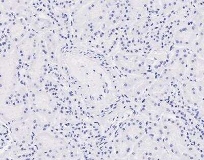 Immunohistochemistry-Paraffin: NIPBL Antibody [NBP1-52168]