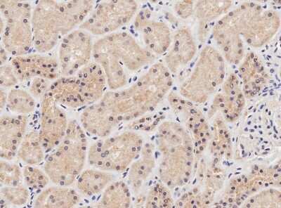 Immunohistochemistry-Paraffin: NIPBL Antibody [NBP1-52168]