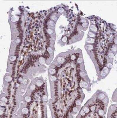 Immunohistochemistry-Paraffin: NIPBL Antibody [NBP1-85110]