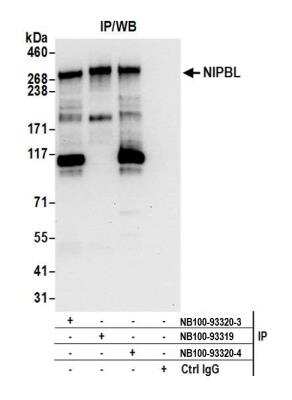 Immunoprecipitation: NIPBL Antibody [NB100-93320]
