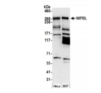 Western Blot: NIPBL Antibody [NB100-93320]