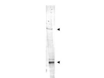 Western Blot: NIPBL Antibody [NBP1-77974]