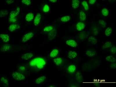 Immunocytochemistry/ Immunofluorescence: NIPP1 Antibody (1G11) [H00005511-M21]