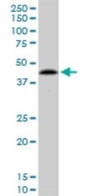 Western Blot: NIPP1 Antibody (1G11) [H00005511-M21]