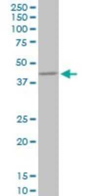 Western Blot: NIPP1 Antibody (1G11) [H00005511-M21]