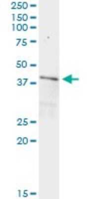 Immunoprecipitation: NIPP1 Antibody (4B5) [H00005511-M05]