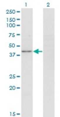 Western Blot: NIPP1 Antibody (4B5) [H00005511-M05]