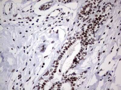 Immunohistochemistry: NIPP1 Antibody (OTI4E5) [NBP2-45386]