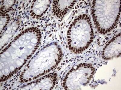 Immunohistochemistry: NIPP1 Antibody (OTI4E5) [NBP2-45386]