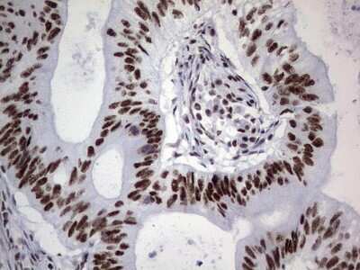 Immunohistochemistry: NIPP1 Antibody (OTI4E5) [NBP2-45386]