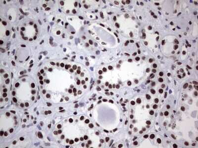 Immunohistochemistry: NIPP1 Antibody (OTI4E5) [NBP2-45386]