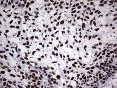 Immunohistochemistry: NIPP1 Antibody (OTI4E5) [NBP2-45386]