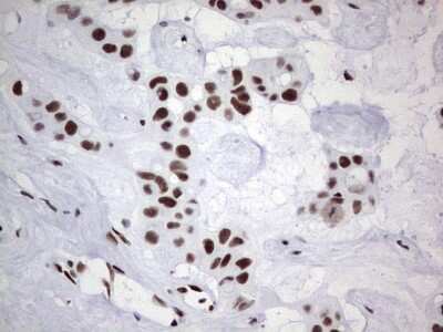 Immunohistochemistry: NIPP1 Antibody (OTI4E5) [NBP2-45386]