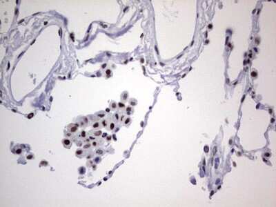 Immunohistochemistry: NIPP1 Antibody (OTI4E5) [NBP2-45386]