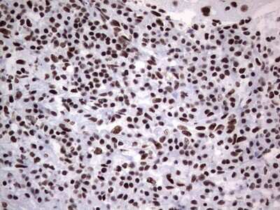 Immunohistochemistry: NIPP1 Antibody (OTI4E5) [NBP2-45386]