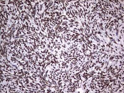 Immunohistochemistry: NIPP1 Antibody (OTI4E5) [NBP2-45386]