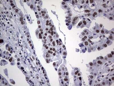 Immunohistochemistry: NIPP1 Antibody (OTI4E5) [NBP2-45386]