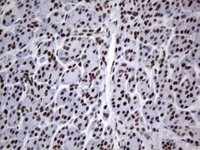 Immunohistochemistry: NIPP1 Antibody (OTI4E5) [NBP2-45386]