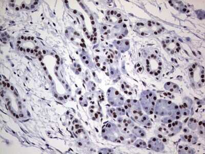 Immunohistochemistry: NIPP1 Antibody (OTI4E5) [NBP2-45386]