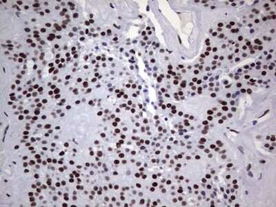 Immunohistochemistry: NIPP1 Antibody (OTI4E5) [NBP2-45386]