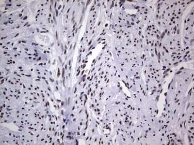 Immunohistochemistry: NIPP1 Antibody (OTI4E5) [NBP2-45386]
