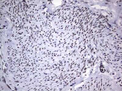 Immunohistochemistry: NIPP1 Antibody (OTI4E5) [NBP2-45386]