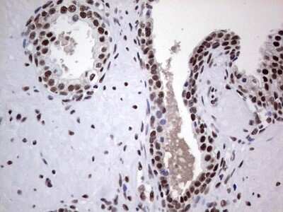 Immunohistochemistry: NIPP1 Antibody (OTI4E5) [NBP2-45386]