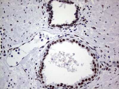 Immunohistochemistry: NIPP1 Antibody (OTI4E5) [NBP2-45386]